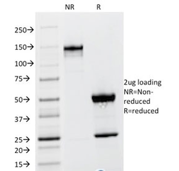 TSHB Antibody / TSH beta