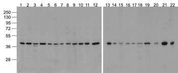 ACTB Antibody (Biotin)