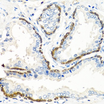 BMP5 Antibody