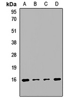 PPP3R1 Rabbit Polyclonal Antibody