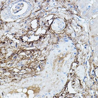 TGFBI Rabbit Polyclonal Antibody