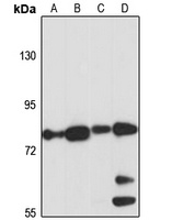 GFAT2 Rabbit Polyclonal Antibody