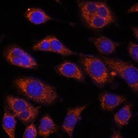 GFAT2 Rabbit Polyclonal Antibody