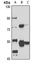ZAK Rabbit Polyclonal Antibody