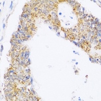 ZAK Rabbit Polyclonal Antibody