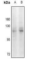 KANK2 Rabbit Polyclonal Antibody