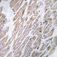 KANK2 Rabbit Polyclonal Antibody