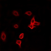 KANK2 Rabbit Polyclonal Antibody