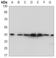 FEN1 Mouse Monoclonal Antibody