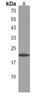 DPPA3 Rabbit Polyclonal Antibody