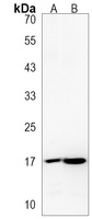 DPPA3 Rabbit Polyclonal Antibody