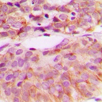 c-SRC (Phospho-Y529) Rabbit Polyclonal Antibody