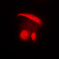 c-SRC Rabbit Polyclonal Antibody