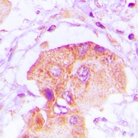 EPS8L2 Rabbit Polyclonal Antibody