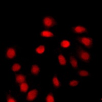 Histone H4 (Acetyl-K12) Rabbit Polyclonal Antibody
