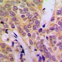c-SRC Rabbit Polyclonal Antibody