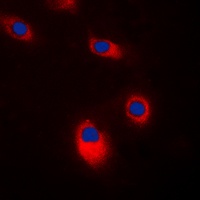 c-SRC Rabbit Polyclonal Antibody
