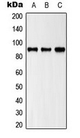 ZAK Rabbit Polyclonal Antibody