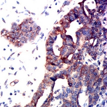 CD126 Mouse Monoclonal Antibody