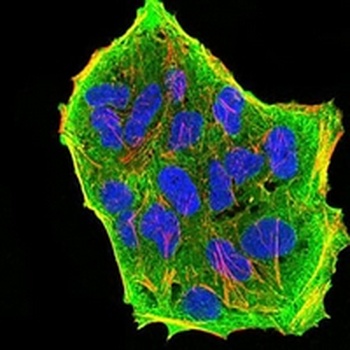 GFAT Mouse Monoclonal Antibody
