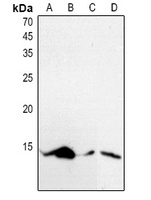 Histone H4 (Acetyl-K5) Rabbit Polyclonal Antibody