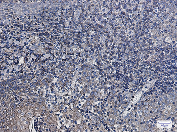 Synaptophysin Like Protein 1 Rabbit mAb Antibody