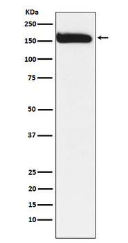 KAT13A / SRC1 Rabbit mAb Antibody