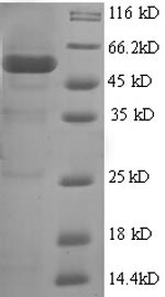 Human BMI1 Protein