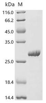 Recombinant Human Endogenous retrovirus group K member 113 Pro protein (HERVK_113)
