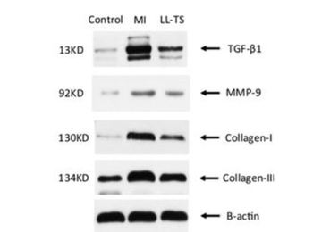10X RIPA Lysis Buffer