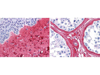 COL3A1 Antibody (Biotin)