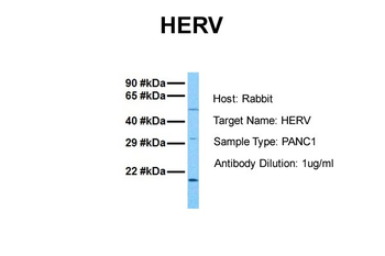 HERV-FRD Rabbit Polyclonal Antibody