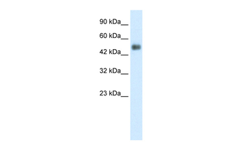 GCM1 Rabbit Polyclonal Antibody