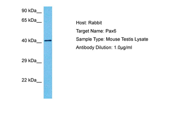 PAX6 Rabbit Polyclonal Antibody
