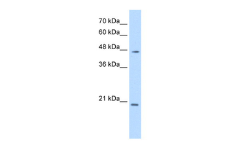 PAX6 Rabbit Polyclonal Antibody