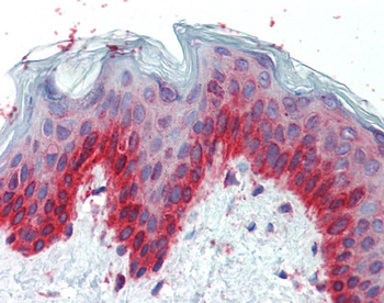 TFAP2C Rabbit Polyclonal Antibody