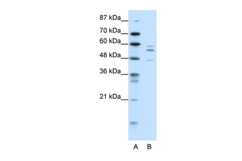 PAX6 Rabbit Polyclonal Antibody