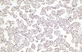 Multi-rAb Polymer HRP-Goat Rabbit Recombinant Secondary Antibody (H+L)