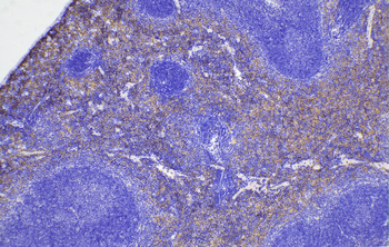 Multi-rAb Polymer HRP-Goat Rabbit Recombinant Secondary Antibody (H+L)