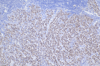 Multi-rAb Polymer HRP-Goat Rabbit Recombinant Secondary Antibody (H+L)