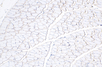 Multi-rAb Polymer HRP-Goat Rabbit Recombinant Secondary Antibody (H+L)