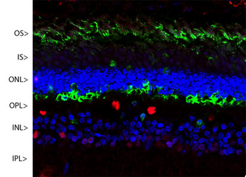 SAG/Arrestin Antibody