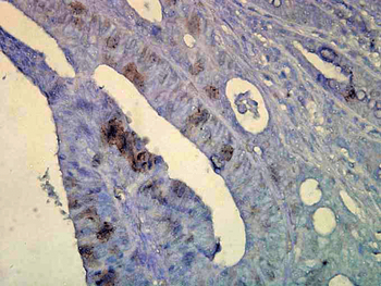 HSP70 Antibody (PerCP)