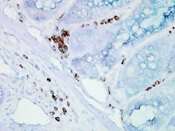 HSP70/HSC70 Antibody (PerCP)