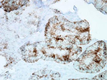 HSP60 Antibody (APC)