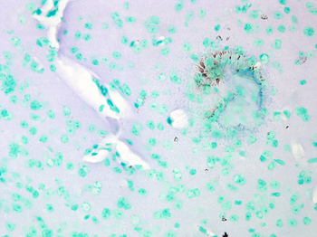 Cav1.2 Antibody (FITC)