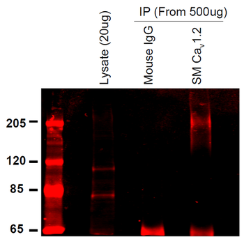 Cav1.2 Antibody (FITC)