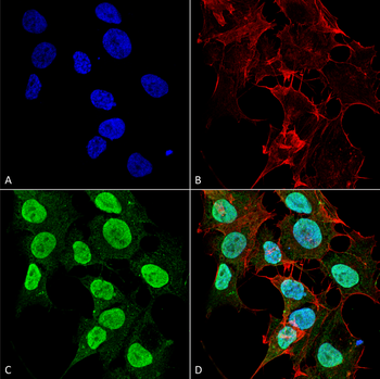 Cav1.2 Antibody (RPE)
