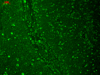 Cav1.2 Antibody (RPE)