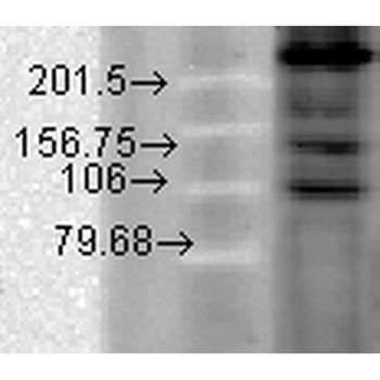 Cav1.2 Antibody (RPE)